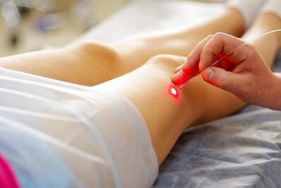 Terapia laserowa