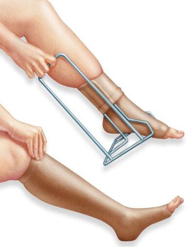 Terapia kompresyjna